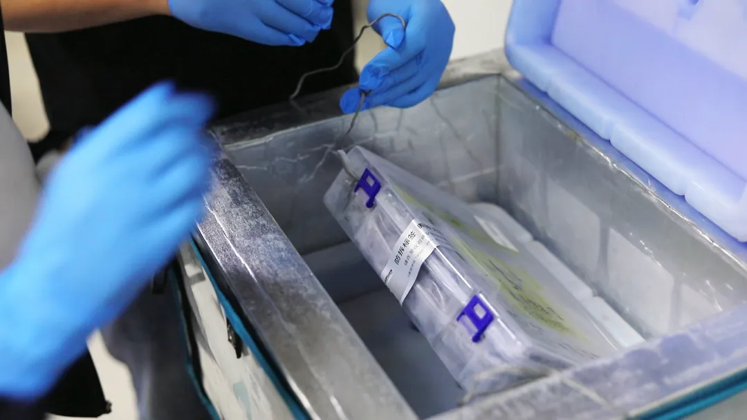 Staff handle the collected cell product in a temperature-controlled cryogenic container
